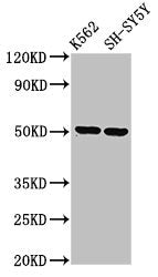 Western Blot  | Positive WB detected in: K562 whole cell lysate, SH-SY5Y whole cell lysate  | All lanes: GPA33 antibody at 3.2µg/ml  | Secondary  | Goat polyclonal to rabbit IgG at 1/50000 dilution  | Predicted band size: 36 kDa  | Observed band size: 50 kDaRabbit anti-Human GPA33 Polyclonal Antibody