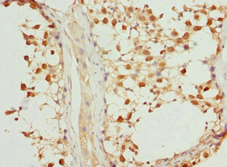 Immunohistochemistry of paraffin-embedded human testis tissue using VRK1 Antibody at dilution of 1:100Rabbit anti-Human VRK1 Polyclonal Antibody