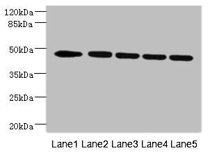 Western blot | All lanes: DCXR antibody at 4.74μg/ml | Lane 1: MCF-7 whole cell lysate | Lane 2: Hela whole cell lysate | Lane 3: A549 whole cell lysate | Lane 4: 293T whole cell lysate | Secondary | Goat polyclonal to rabbit IgG at 1/10000 dilution | Predicted band size: 45 kDa | Observed band size: 45 kDaRabbit anti-Human VRK1 Polyclonal Antibody