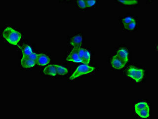 Immunofluorescent analysis of HepG2 cells using EIF3C Antibody at dilution of 1:100 and Alexa Fluor 488-congugated AffiniPure Goat Anti-Rabbit IgG(H+L)Rabbit anti-Human EIF3C Polyclonal Antibody