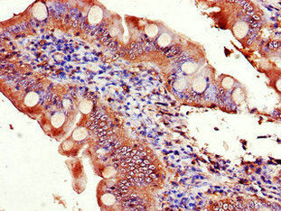 Immunohistochemistry of paraffin-embedded human small intestine tissue using EIF3C Antibody at dilution of 1:100Rabbit anti-Human EIF3C Polyclonal Antibody