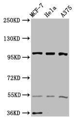 Western Blot | Positive WB detected in: MCF-7 whole cell lysate, Hela whole cell lysate, A375 whole cell lysate | All lanes: EIF3C antibody at 3.4μg/ml | Secondary | Goat polyclonal to rabbit IgG at 1/50000 dilution | Predicted band size: 106, 105 kDa | Observed band size: 106 kDaRabbit anti-Human EIF3C Polyclonal Antibody