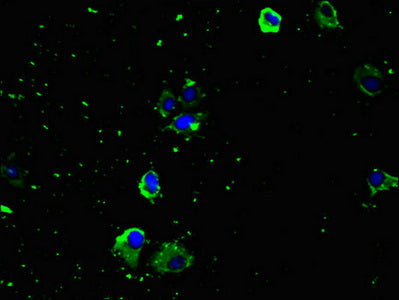 Immunofluorescent analysis of U251 cells using SLC29A1 Antibody at dilution of 1:100 and Alexa Fluor 488-congugated AffiniPure Goat Anti-Rabbit IgG(H+L)Rabbit anti-Human SLC29A1 Polyclonal Antibody