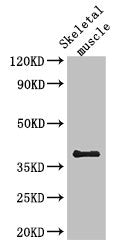 Western Blot | Positive WB detected in: Mouse skeletal muscle tissue | All lanes: KIR2DL3 antibody at 2.7μg/ml | Secondary | Goat polyclonal to rabbit IgG at 1/50000 dilution | Predicted band size: 51, 59 kDa | Observed band size: 38 kDaRabbit anti-Human SLC29A1 Polyclonal Antibody