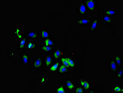 Immunofluorescent analysis of A549 cells using SMO Antibody at dilution of 1:100 and Alexa Fluor 488-congugated AffiniPure Goat Anti-Rabbit IgG(H+L)Rabbit anti-Human SMO Polyclonal Antibody