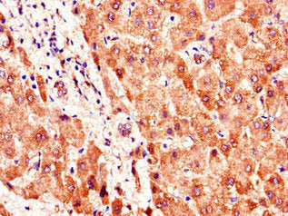 Immunohistochemistry of paraffin-embedded human liver tissue using SMO Antibody at dilution of 1:100Rabbit anti-Human SMO Polyclonal Antibody