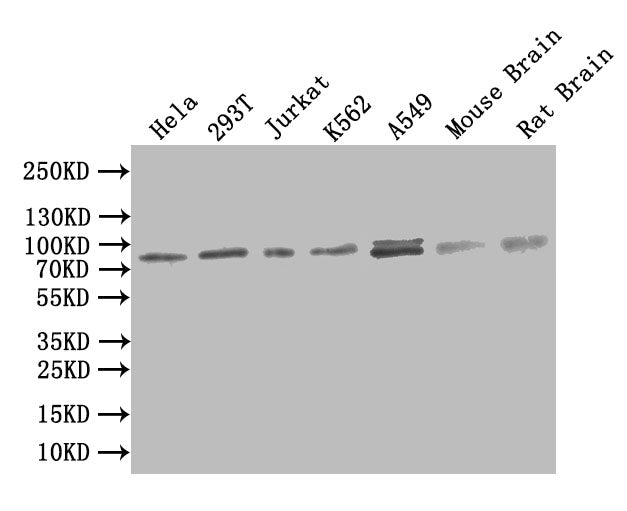 Western Blot | Positive WB detected in: Mouse liver tissue, Mouse kidney tissue | All lanes: SMO antibody at 2μg/ml | Secondary | Goat polyclonal to rabbit IgG at 1/50000 dilution | Predicted band size: 87 kDa | Observed band size: 87 kDaRabbit anti-Human SMO Polyclonal Antibody
