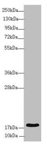 Western blot | All lanes: RNF5 antibody at 3.94 μg/ml + Mouse gonadal tissue | Secondary | Goat polyclonal to rabbit IgG at 1/10000 dilution | Predicted band size: 20 kDa | Observed band size: 20 kDaRabbit anti-Human RNF5 Polyclonal Antibody