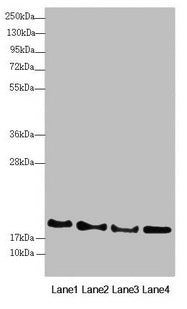 Western blot  | All lanes: RNF5 antibody at 3.08µg/ml  | Lane 1: A431 whole cell lysate  | Lane 2: Jurkat whole cell lysate  | Lane 3: Hela whole cell lysate  | Lane 4: HepG2 whole cell lysate  | Secondary  | Goat polyclonal to rabbit IgG at 1/10000 dilution  | Predicted band size: 20 kDa  | Observed band size: 20 kDaRabbit anti-Human RNF5 Polyclonal Antibody