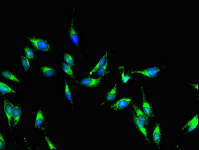 Immunofluorescent analysis of Hela cells using AKAP9 Antibody at dilution of 1:100 and Alexa Fluor 488-congugated AffiniPure Goat Anti-Rabbit IgG(H+L)