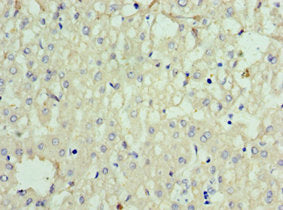Immunohistochemistry of paraffin-embedded human liver tissue using the antibody at dilution of 1:100Rabbit anti-Human SOST Polyclonal Antibody