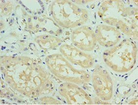 Immunohistochemistry of paraffin-embedded human kidney tissue using SOST Antibody at dilution of 1:100Rabbit anti-Human SOST Polyclonal Antibody