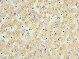 Immunohistochemistry of paraffin-embedded human liver tissue using SOST Antibody at dilution of 1:100Rabbit anti-Human SOST Polyclonal Antibody
