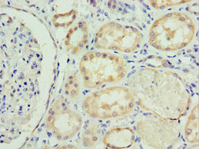 Immunohistochemistry of paraffin-embedded human kidney tissue using SOST Antibody at dilution of 1:100Rabbit anti-Human SOST Polyclonal Antibody