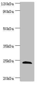 Western blot | All lanes: SOST antibody at 4μg/ml + Hela whole cell lysate | Secondary | Goat polyclonal to rabbit IgG at 1/10000 dilution | Predicted band size: 24 kDa | Observed band size: 24 kDaRabbit anti-Human SOST Polyclonal Antibody