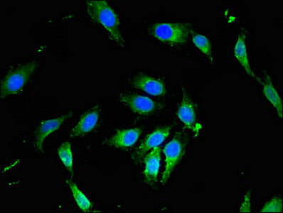 Immunofluorescent analysis of Hela cells using PIK3R4 Antibody at dilution of 1:100 and Alexa Fluor 488-congugated AffiniPure Goat Anti-Rabbit IgG(H+L)Rabbit anti-Human PIK3R4 Polyclonal Antibody