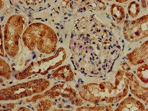 Immunohistochemistry of paraffin-embedded human kidney tissue using the antibody at dilution of 1:100Rabbit anti-Human PIK3R4 Polyclonal Antibody