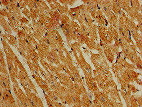 Immunohistochemistry of paraffin-embedded human heart tissue using PIK3R4 Antibody at dilution of 1:100Rabbit anti-Human PIK3R4 Polyclonal Antibody
