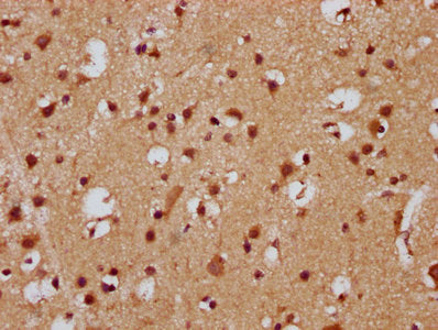 IHC image of FEV Antibody diluted at 1:300 and staining in paraffin-embedded human brain tissue performed on a Leica BondTM system. After dewaxing and hydration, antigen retrieval was mediated by high pressure in a citrate buffer (pH 6.0). Section was blocked with 10% normal goat serum 30min at RT. Then primary antibody (1% BSA) was incubated at 4°C overnight. The primary is detected by a biotinylated secondary antibody and visualized using an HRP conjugated SP system.Rabbit anti-Human FEV Polyclonal Antibody