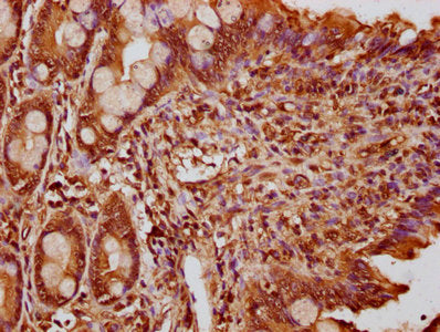 IHC image of FEV Antibody diluted at 1:300 and staining in paraffin-embedded human small intestine tissue performed on a Leica BondTM system. After dewaxing and hydration, antigen retrieval was mediated by high pressure in a citrate buffer (pH 6.0). Section was blocked with 10% normal goat serum 30min at RT. Then primary antibody (1% BSA) was incubated at 4°C overnight. The primary is detected by a biotinylated secondary antibody and visualized using an HRP conjugated SP system.Rabbit anti-Human FEV Polyclonal Antibody