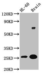 Western Blot  | Positive WB detected in: HL60 whole cell lysate, Rat brain tissue  | All lanes: FEV antibody at 5.9µg/ml  | Secondary  | Goat polyclonal to rabbit IgG at 1/50000 dilution  | Predicted band size: 26 kDa  | Observed band size: 26 kDaRabbit anti-Human FEV Polyclonal Antibody