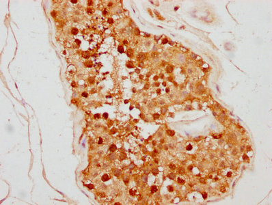 IHC image of TSNAX Antibody diluted at 1:500 and staining in paraffin-embedded human testis tissue performed on a Leica BondTM system. After dewaxing and hydration, antigen retrieval was mediated by high pressure in a citrate buffer (pH 6.0). Section was blocked with 10% normal goat serum 30min at RT. Then primary antibody (1% BSA) was incubated at 4°C overnight. The primary is detected by a biotinylated secondary antibody and visualized using an HRP conjugated SP system.Rabbit anti-Human TSNAX Polyclonal Antibody