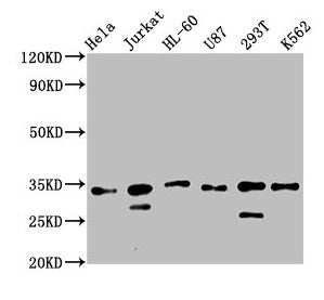 Western Blot  | Positive WB detected in: Hela whole cell lysate, Jurkat whole cell lysate, HL60 whole cell lysate, U87 whole cell lysate, 293T whole cell lysate, K562 whole cell lysate  | All lanes: TSNAX antibody at 2.5µg/ml  | Secondary  | Goat polyclonal to rabbit IgG at 1/50000 dilution  | Predicted band size: 34 kDa  | Observed band size: 34 kDaRabbit anti-Human TSNAX Polyclonal Antibody