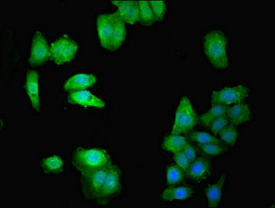 Immunofluorescent analysis of HepG2 cells using DOK1 Antibody at dilution of 1:100 and Alexa Fluor 488-congugated AffiniPure Goat Anti-Rabbit IgG(H+L)Rabbit anti-Human DOK1 Polyclonal Antibody
