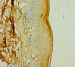 Immunohistochemistry of paraffin-embedded human skin tissue using the antibody at dilution of 1:100Rabbit anti-Human DOK1 Polyclonal Antibody