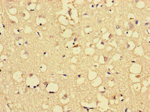 Immunohistochemistry of paraffin-embedded human brain tissue using ARHGDIG Antibody at dilution of 1:100Rabbit anti-Human ARHGDIG Polyclonal Antibody