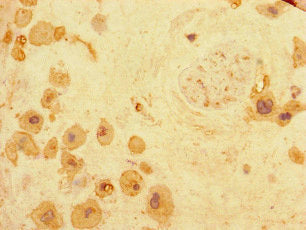 Immunohistochemistry of paraffin-embedded human placenta tissue using ARHGDIG Antibody at dilution of 1:100Rabbit anti-Human ARHGDIG Polyclonal Antibody