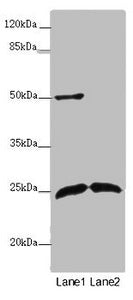 Western blot | All lanes: ARHGDIG antibody at 2 μg/ml | Lane 1: Mouse brain tissue | Lane 2: Mouse lung tissue | Secondary | Goat polyclonal to rabbit IgG at 1/10000 dilution | Predicted band size: 25 kDa | Observed band size: 25, 50 kDaRabbit anti-Human ARHGDIG Polyclonal Antibody