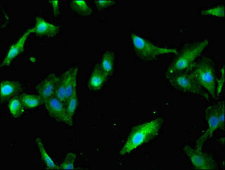 Immunofluorescent analysis of Hela cells using PAIP2 Antibody at dilution of 1:100 and Alexa Fluor 488-congugated AffiniPure Goat Anti-Rabbit IgG(H+L)Rabbit anti-Human PAIP2 Polyclonal Antibody