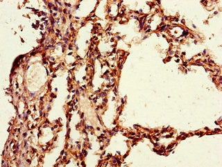 Immunohistochemistry of paraffin-embedded human lung tissue using PAIP2 Antibody at dilution of 1:100Rabbit anti-Human PAIP2 Polyclonal Antibody