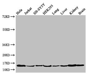 Western Blot  | Positive WB detected in: Hela whole cell lysate, Jurkat whole cell lysate, SH-SY5Y whole cell lysate, HEK293 whole cell lysate, Mouse lung tissue, Mouse liver tissue, Mouse kidney tissue, Mouse brain tissue  | All lanes: PAIP2 antibody at 3.5µg/ml  | Secondary  | Goat polyclonal to rabbit IgG at 1/50000 dilution  | Predicted band size: 15 kDa  | Observed band size: 15 kDaRabbit anti-Human PAIP2 Polyclonal Antibody