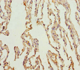 Immunohistochemistry of paraffin-embedded human lung tissue using KCNS3 Antibody at dilution of 1:100