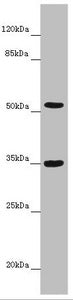 Western blot | All lanes: KCNS3 antibody at 6.35 μg/ml + Mouse lung tissue | Secondary | Goat polyclonal to rabbit IgG at 1/10000 dilution | Predicted band size: 56 kDa | Observed band size: 56, 35 kDa