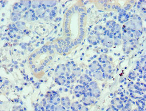 Immunohistochemistry of paraffin-embedded human pancreatic tissue using WDR77 Antibody at dilution of 1:100Rabbit anti-Human WDR77 Polyclonal Antibody