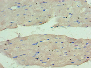 Immunohistochemistry of paraffin-embedded human skeletal muscle tissue using WDR77 Antibody at dilution of 1:100Rabbit anti-Human WDR77 Polyclonal Antibody