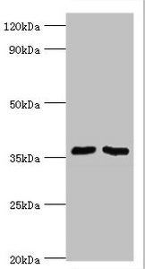 Western blot | All lanes: Methylosome protein 50 antibody at 6μg/ml | Lane 1: Hela whole cell lysate | Lane 2: HepG2 whole cell lysate | Secondary | Goat polyclonal to rabbit IgG at 1/10000 dilution | Predicted band size: 37, 30 kDa | Observed band size: 37 kDaRabbit anti-Human WDR77 Polyclonal Antibody