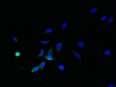 Immunofluorescent analysis of HepG2 cells using SDHC Antibody at dilution of 1:100 and Alexa Fluor 488-congugated AffiniPure Goat Anti-Rabbit IgG(H+L)Rabbit anti-Human SDHC Polyclonal Antibody