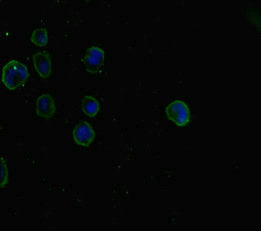 Immunofluorescent analysis of MCF-7 cells using SMAD5 Antibody at dilution of 1:100 and Alexa Fluor 488-congugated AffiniPure Goat Anti-Rabbit IgG(H+L)Rabbit anti-Human SMAD5 Polyclonal Antibody