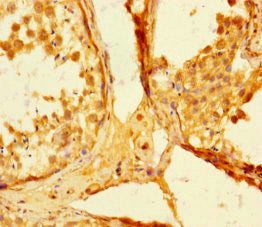 Immunohistochemistry of paraffin-embedded human testis tissue using SMAD5 Antibody at dilution of 1:100Rabbit anti-Human SMAD5 Polyclonal Antibody