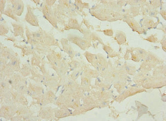 Immunohistochemistry of paraffin-embedded human heart tissue using PIP5K1A Antibody at dilution of 1:100Rabbit anti-Human PIP5K1A Polyclonal Antibody