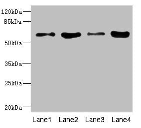 Western blot | All lanes: PIP5K1A antibody at 4.12μg/ml | Lane 1: Hela whole cell lysate | Lane 2: A431 whole cell lysate | Lane 3: Mouse heart tissue | Lane 4: Mouse kidney tissue | Secondary | Goat polyclonal to rabbit IgG at 1/10000 dilution | Predicted band size: 63, 57, 62, 59 kDa | Observed band size: 63 kDaRabbit anti-Human PIP5K1A Polyclonal Antibody