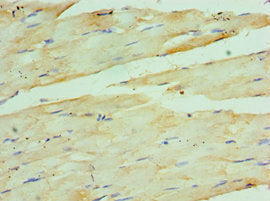 Immunohistochemistry of paraffin-embedded human skeletal muscle tissue using COQ7 Antibody at dilution of 1:100Rabbit anti-Human COQ7 Polyclonal Antibody