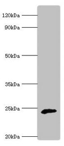 Western blot | All lanes: Ubiquinone biosynthesis protein COQ7 homolog antibody at 6μg/ml + Rat heart tissue | Secondary | Goat polyclonal to rabbit IgG at 1/10000 dilution | Predicted band size: 25, 21 kDa | Observed band size: 25 kDaRabbit anti-Human COQ7 Polyclonal Antibody