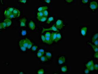 Immunofluorescence staining of MCF-7 cells with CCT7 Antibody at 1:100, counter-stained with DAPI. The cells were fixed in 4% formaldehyde, permeabilized using 0.2% Triton X-100 and blocked in 10% normal Goat Serum. The cells were then incubated with the antibody overnight at 4°C. The secondary antibody was Alexa Fluor 488-congugated AffiniPure Goat Anti-Rabbit IgG(H+L).Rabbit anti-Human CCT7 Polyclonal Antibody