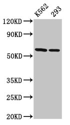 Western Blot  | Positive WB detected in: K562 whole cell lysate, 293 whole cell lysate  | All lanes: CCT7 antibody at 3µg/ml  | Secondary  | Goat polyclonal to rabbit IgG at 1/50000 dilution  | Predicted band size: 60, 38, 55, 51 kDa  | Observed band size: 60 kDaRabbit anti-Human CCT7 Polyclonal Antibody