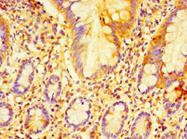 Immunohistochemistry of paraffin-embedded human small intestine tissue using ECSIT Antibody at dilution of 1:100Rabbit anti-Human ECSIT Polyclonal Antibody
